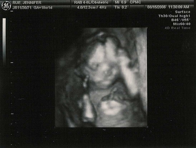 18weeks3dbw